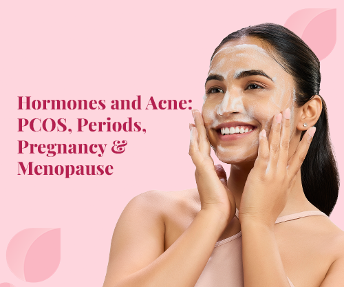Hormones and Acne: PCOS, Periods, Pregnancy & Menopause