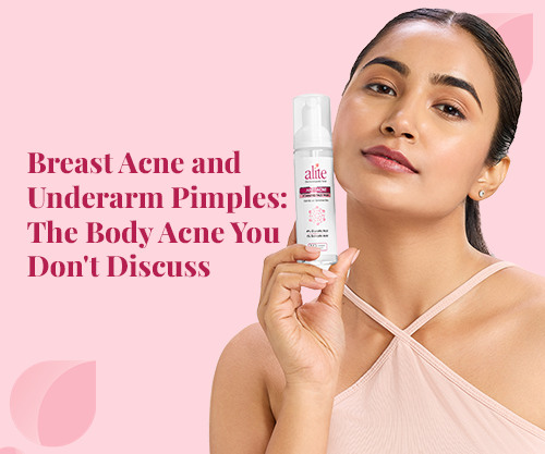 Breast Acne and Underarm Pimples: The Body Acne You Don't Discuss