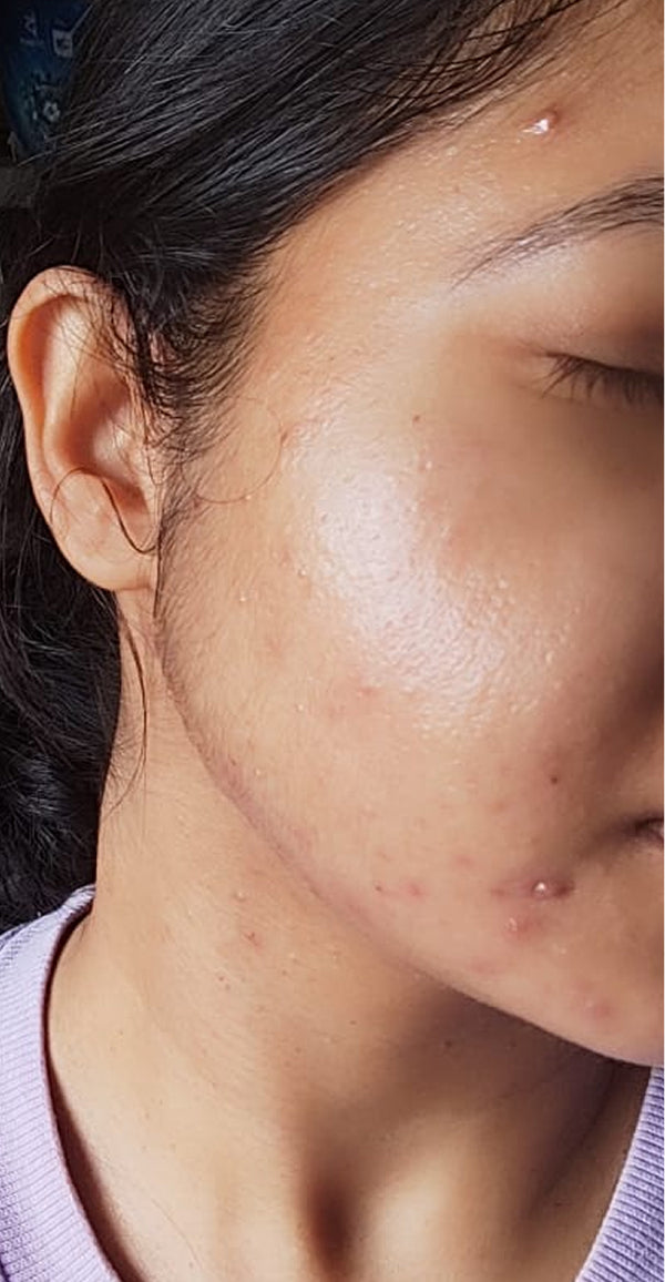 Anjali R.