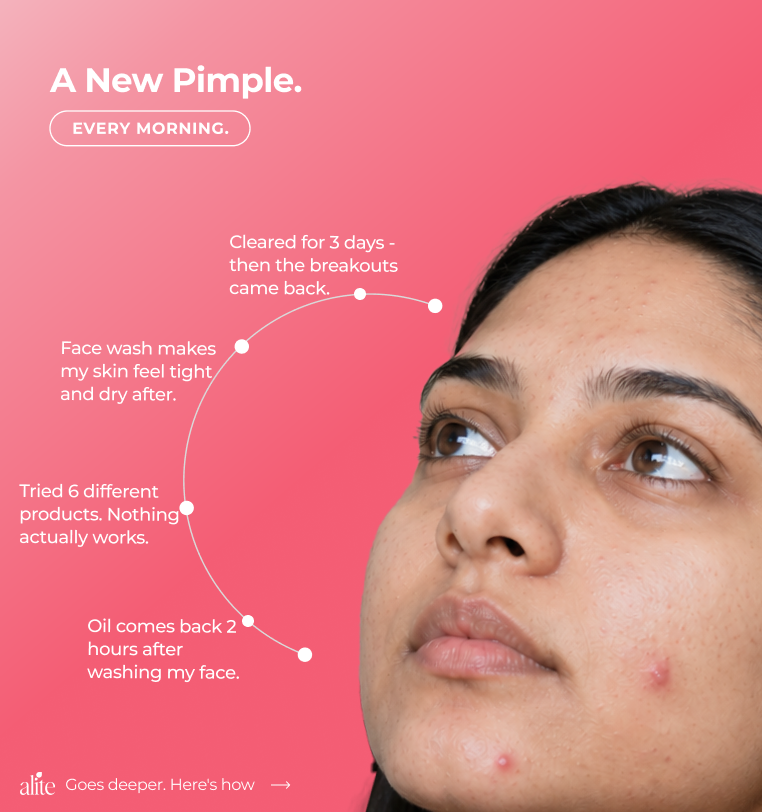 Woman with acne and text about skincare issues