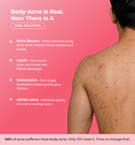 Back of a person with acne 