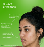 Woman with acne and text about skin concerns