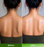 Before and after comparison of a persons back with visible scarring