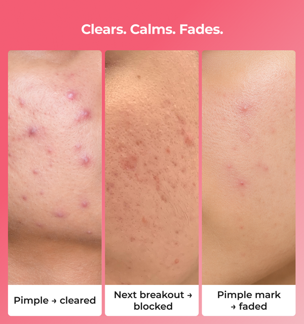 Before and after skin treatment results 