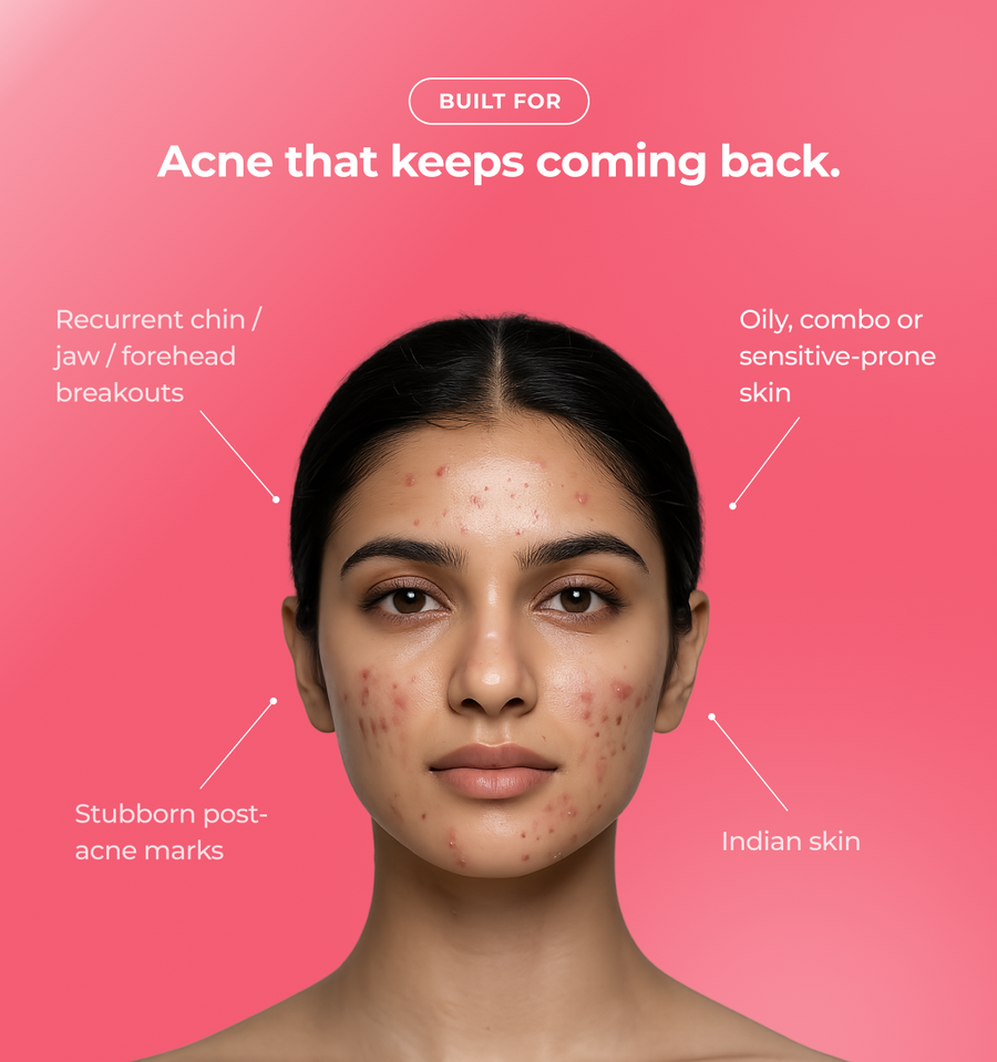 Woman with acne with text about skin conditions