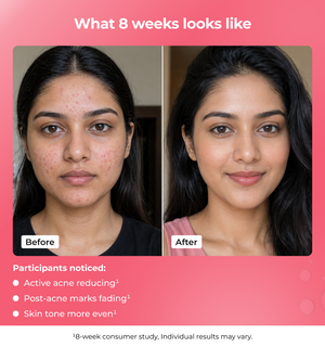Before and after of a woman’s face showing 8 week results