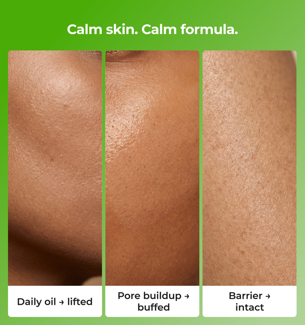 Three panels showing different skin conditions  