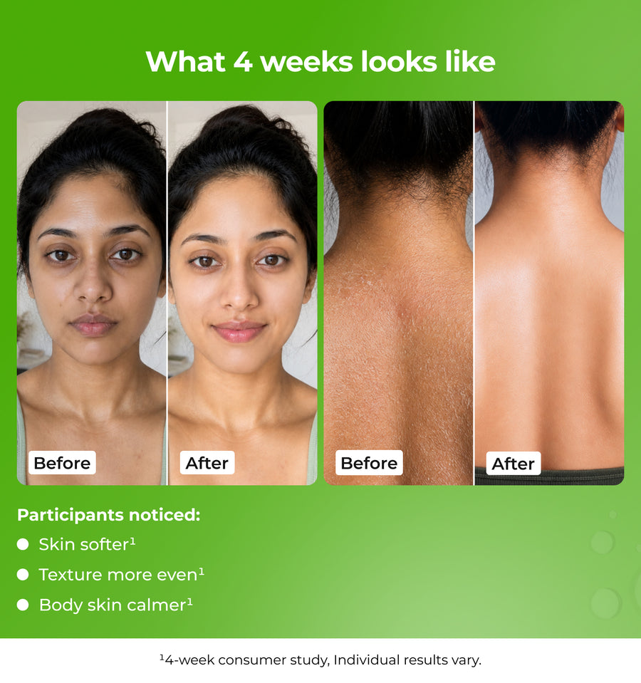 Before and after comparison of a woman's skin  with text about results.