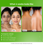 Before and after comparison of a womans face and back 