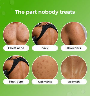 Illustrations of different body parts with text indicating common skin concerns 