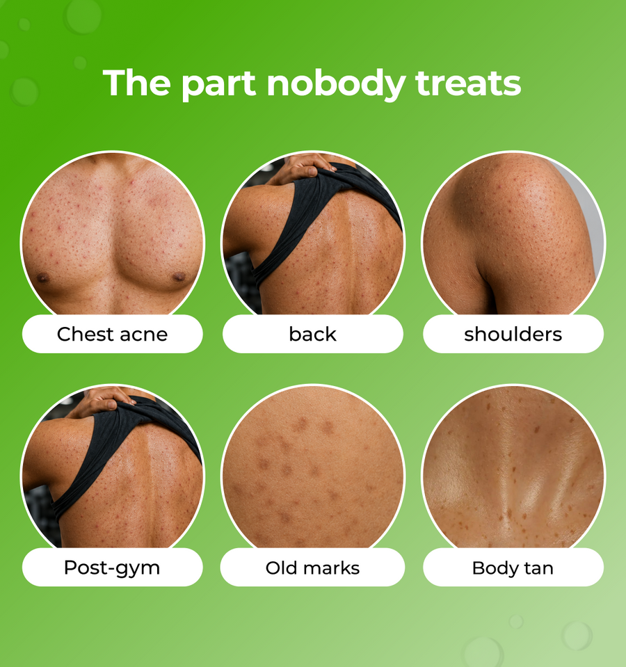 Illustrations of different body parts with text indicating common skin concerns 