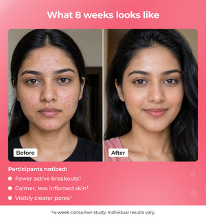 Before and after comparison of a womans face 