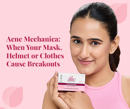 Acne Mechanica: When Your Mask, Helmet or Clothes Cause Breakouts
