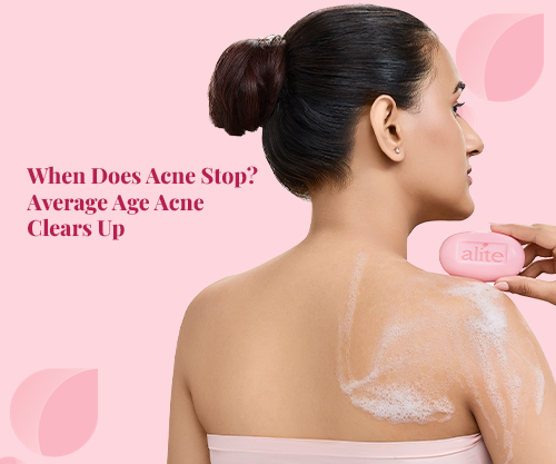 When Does Acne Stop? Average Age Acne Clears Up