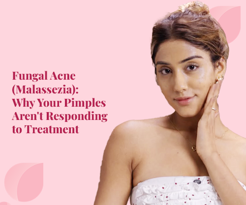 Fungal Acne (Malassezia): Why Your Pimples Aren't Responding to Treatment