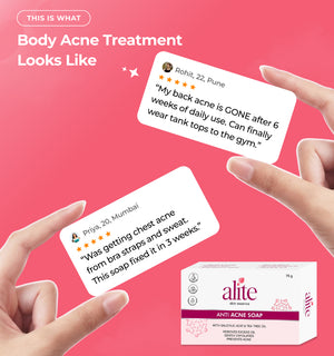Advertisement for alite anti acne soap with customer reviews