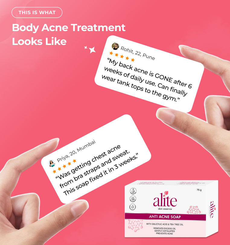Advertisement for alite anti acne soap with customer reviews