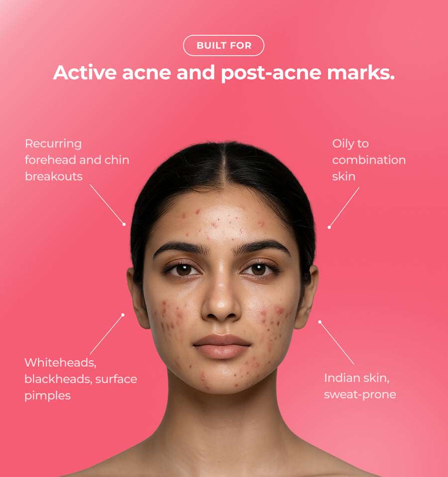 Woman with acne and text about skin conditions