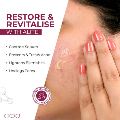 Alite Anti Acne Gel 30 gm | Fast Action on Acne, Pimples | Treats, Repairs, Prevents Acne