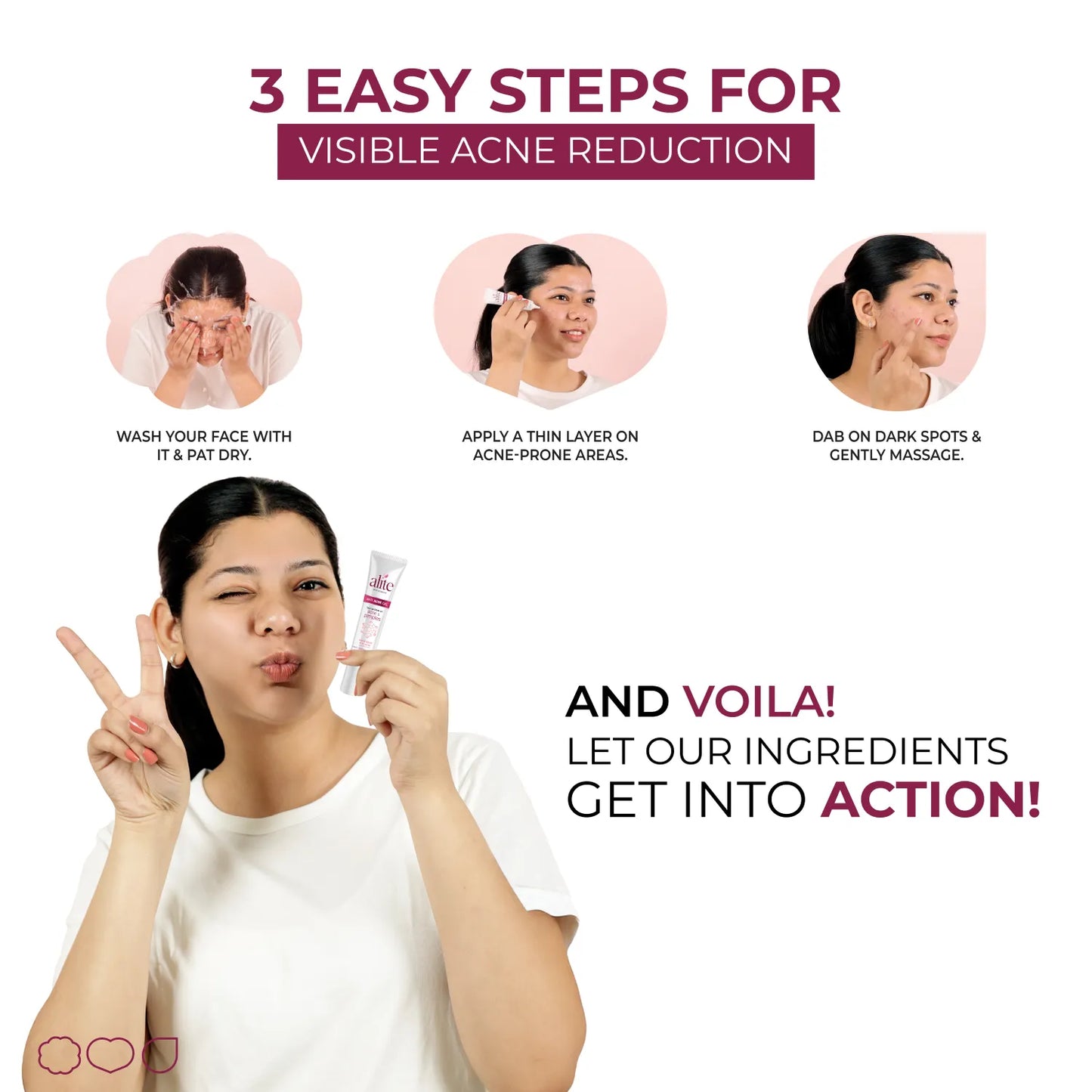 Alite Anti Acne Gel 30 gm | Fast Action on Acne, Pimples | Treats, Repairs, Prevents Acne