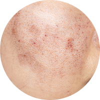 Pigmentation & Spots