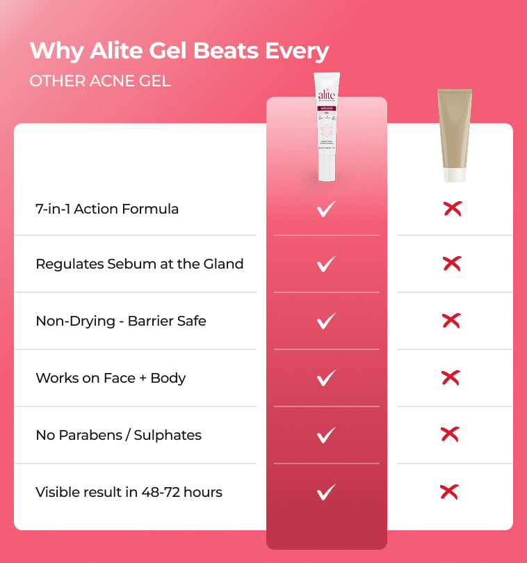 Comparison chart of alite gels benefits against other acne gels 